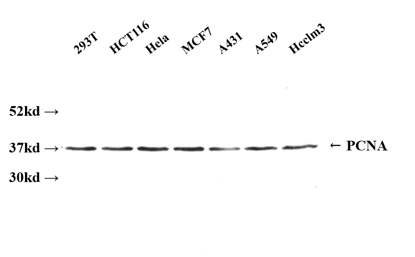 PCNA_重庆昆仑生物有限公司